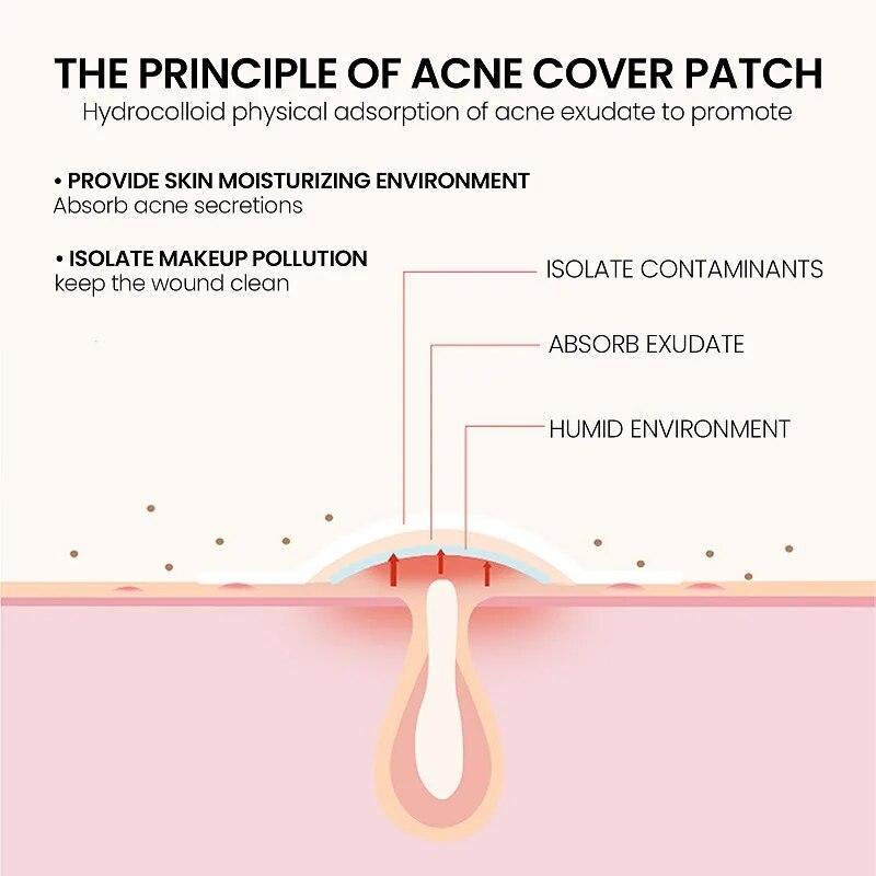 Acne Patch Lighten Acne Spots Repair Skin Blemishes Acne Patch