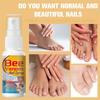 Bee Venom Nail Spray - Extra Strength Toenail and Fingernail Care Serum - Fast-Acting Formula for Fragile Abnormal Rough Fingers