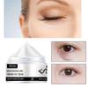 Whitening Eye Cream Enhances the Skin Around the Eyes, Repairs Damaged Skin, Brightens and Moisturizes with Moisturizing Cream