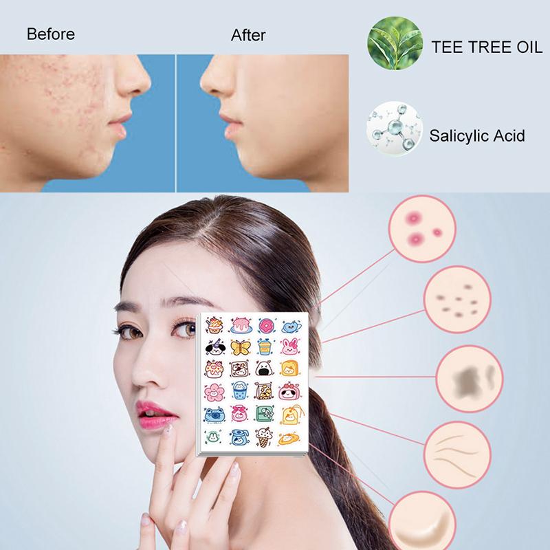 96Pcs Acne Patches Cartoon Cat Shaped Acne Treatment Sticker Invisible Acne Cover Removal Pimple Patch Skin Care