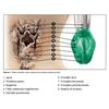 Laryngeal Mask I Gel Size 1 For Newborns Intubation Breathing Mask I-Gel 1 Piece