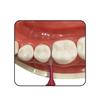 Ebisu Daily Cap Interdental Brush 20 PiecesSSS