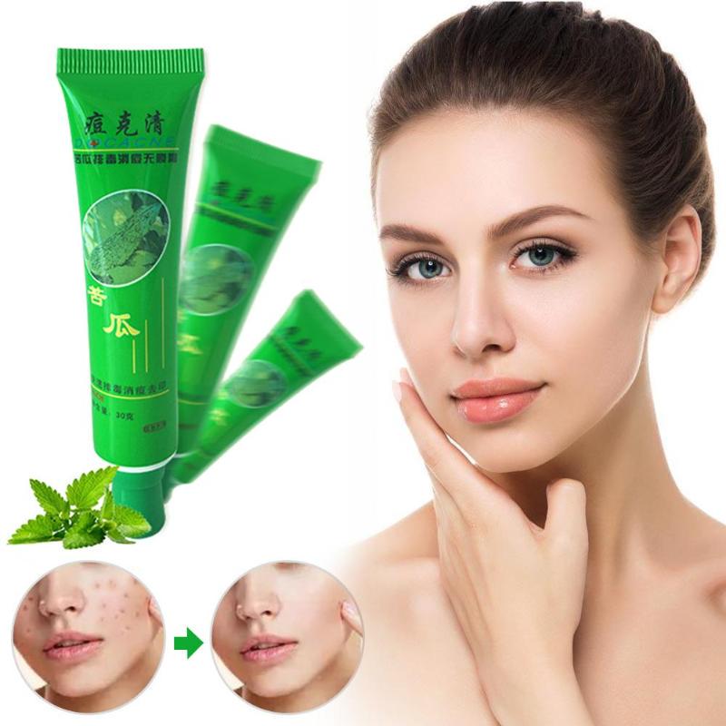 Bitter Gourd Acne Removal Cream Oil Control Acne Face Cream Quick Absorbsbuy at a low prices on