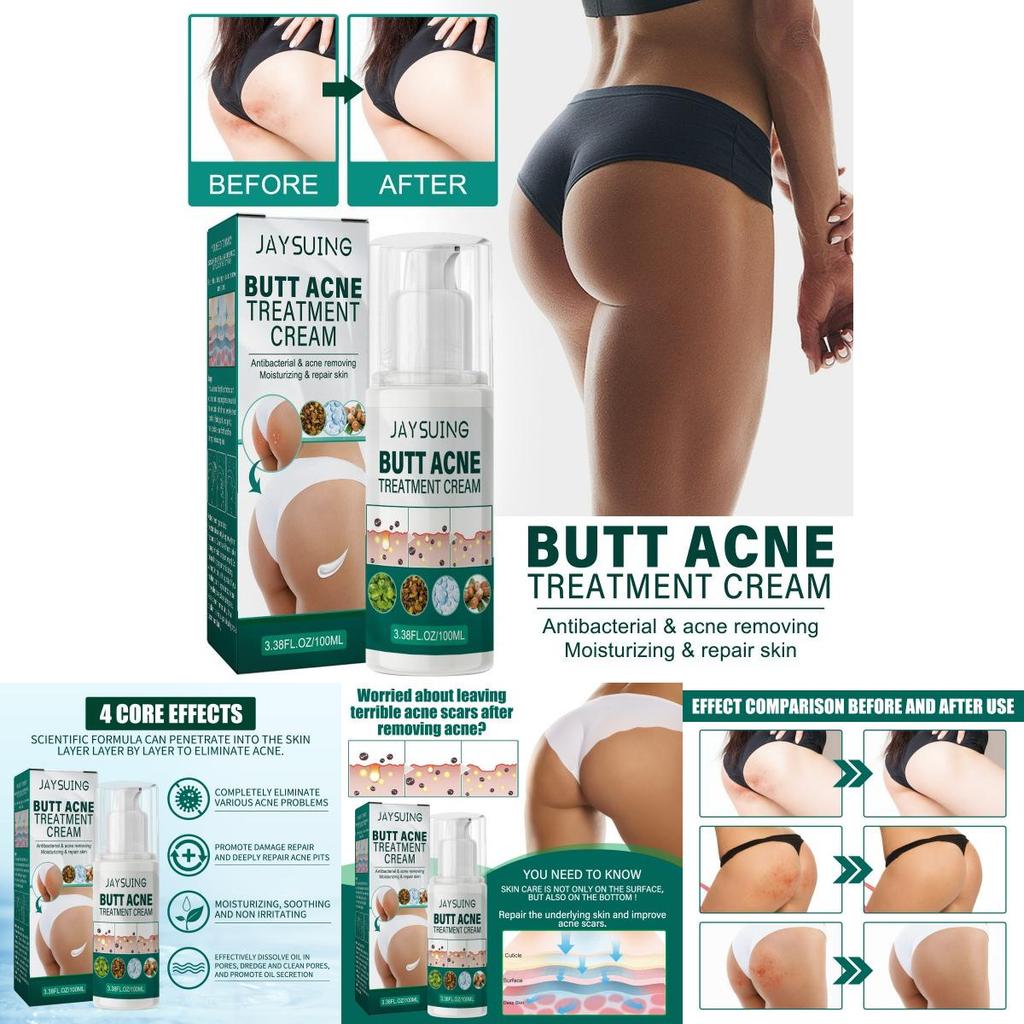 Jaysuing Butt Care Cream Nourishing Moisturizing Formula For Clear And Smooth Skin