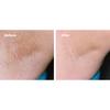 Tend Skin Liquid La Soluzione per la Cura della Pelle 118ml – Cura Post-Rasatura, Levigante per la Pelle, Coreano