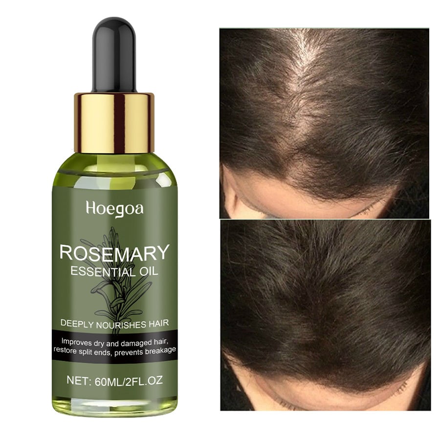 1 Bottle Rosemary Hair Oil, Nourishing & Moisturizing, Smoothens Hair, Protects Hair From Damage, No
