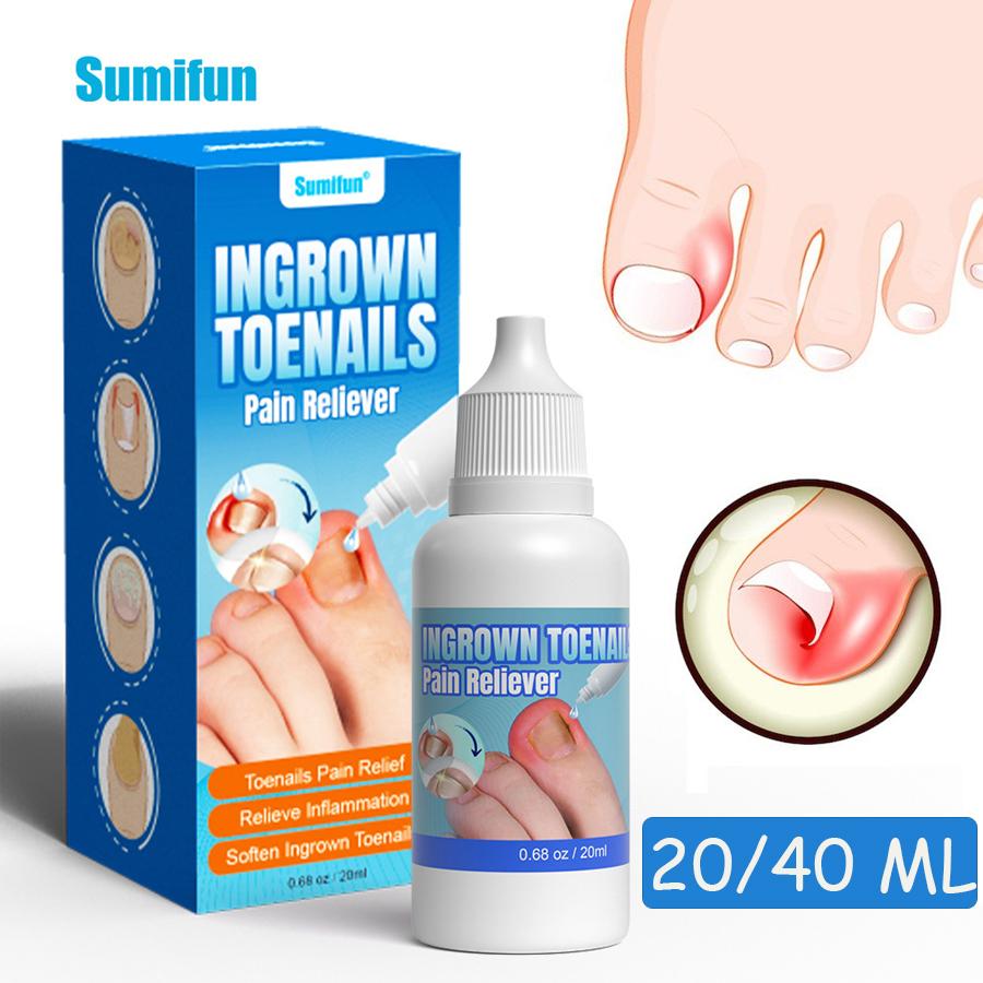 Sumifun 20/40 ML Gray Nails Repair Liquid Relieved Gray Stinky Nail Nourish Moisturize Nails Summer Essential