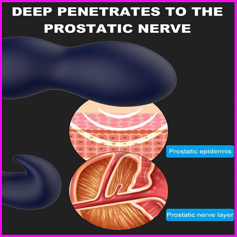 Male Prostate Massager 10 Speed Anal Vibrators for Men Male Masturbator Prostate Massage Remote Control Anal Butt Plug Erotic Adult SexToy for Women