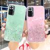 For Samsung Galaxy S20 FE Case Bling Glitter Cover Samsung A51 Note 10 20 Ultra A72 A52 A71 A70 A50 S20 Plus S 20 S20Fe S21 Case