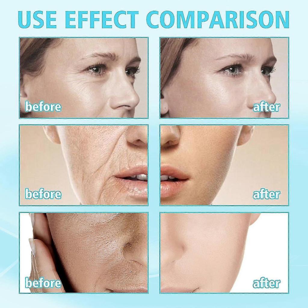 Ouhoe Hyaluronic Acid Anti aging Gel Mask Fades Fine Lines, Moisturizes And Moisturizes The Skin, Skin Care Mask      4044829571781