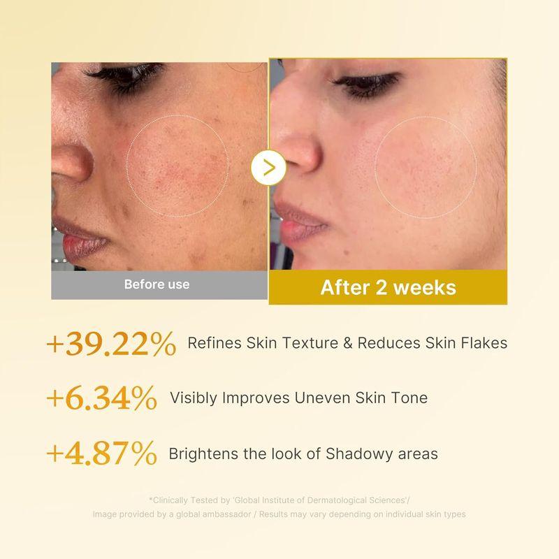 [MEDICUBE] Kojic Acid Turmeric Resurfacing Toner 200ml