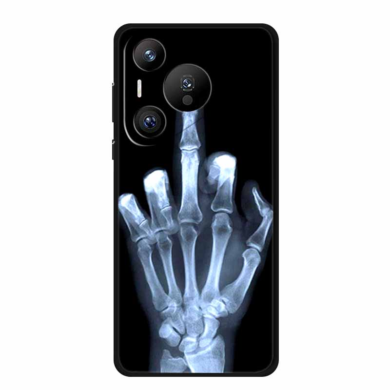 For Huawei Pura 70 Pro Case Luxury TPU Soft Silicone Phone Cover for Huawei Pura 70 Pro+ Pura70 Protective Shockproof New Fundas