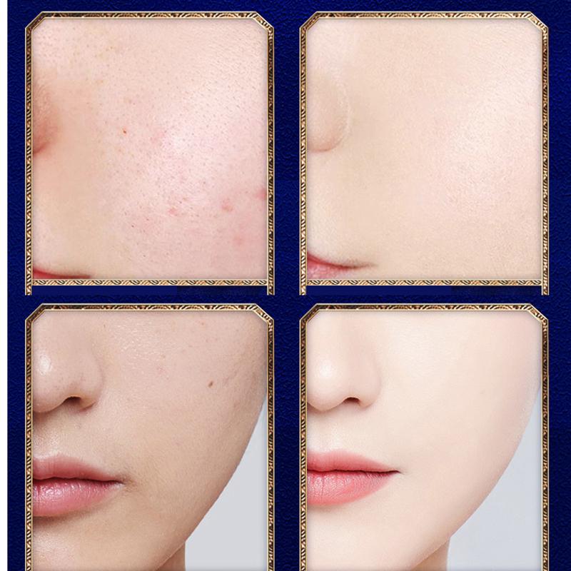 Mushroom Cushion Bb Cream Light and Breathable Makeup Loose Powder Natural Concealer Isolation Repair Beauty Cream