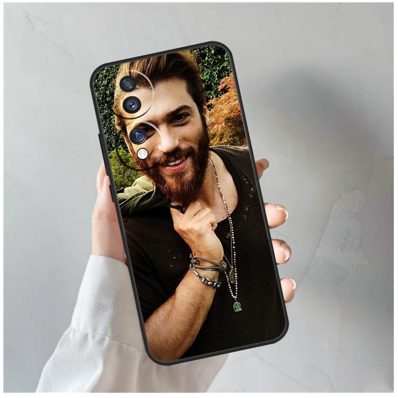 

Can Yaman For Honor Magic 7 Lite 6 5 8 Pro Case For Honor X9d X9b X9c X9a X8c X8b 200 400 50 70 Win RT Honor Magic7 Pro