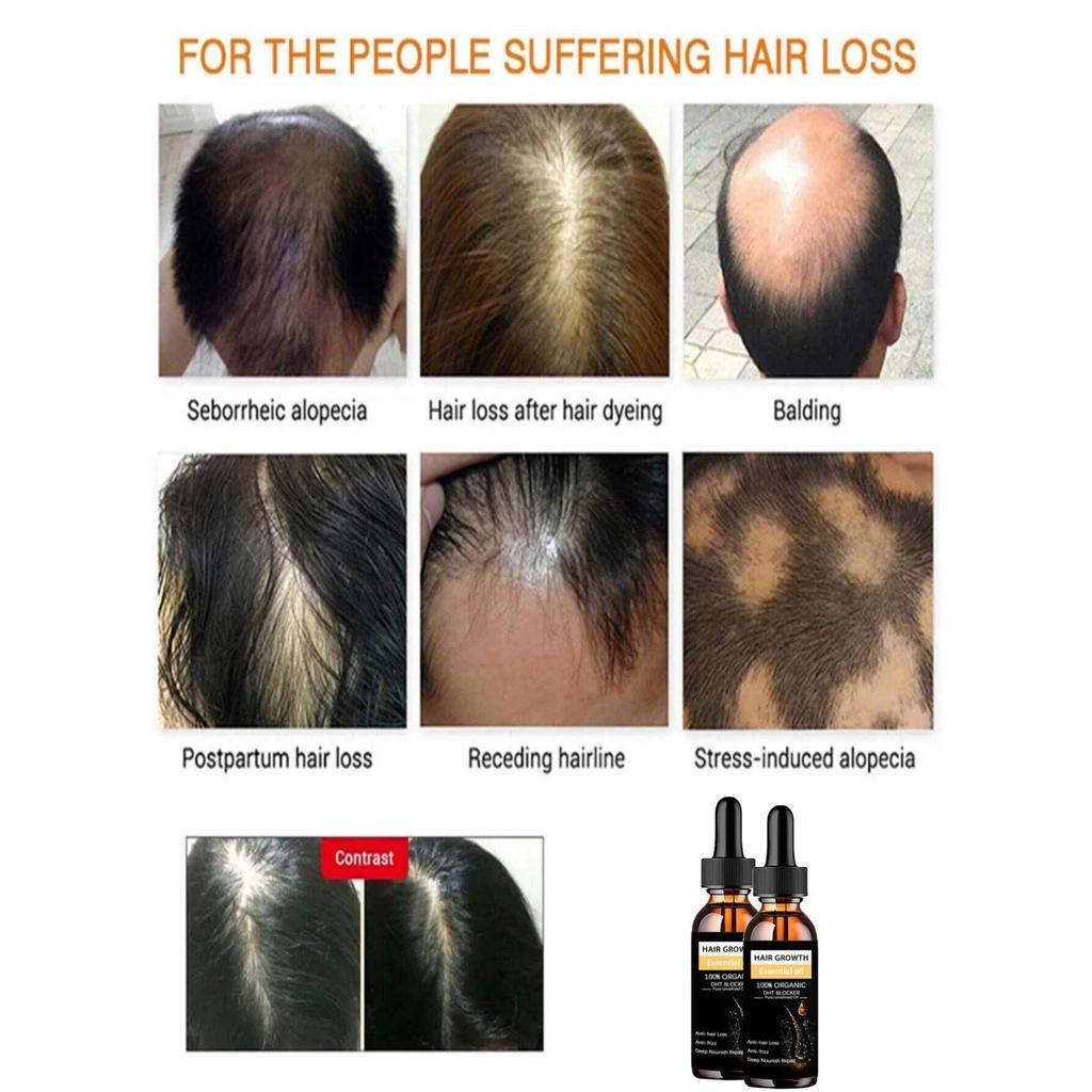 Siyah Hint Yağı Saç Büyümesini Besler Cilt Masajı Uçucu Yağ Kaşları Büyütür Cildin Yaşlanmasını Önler Saç Bakım Ürünleri