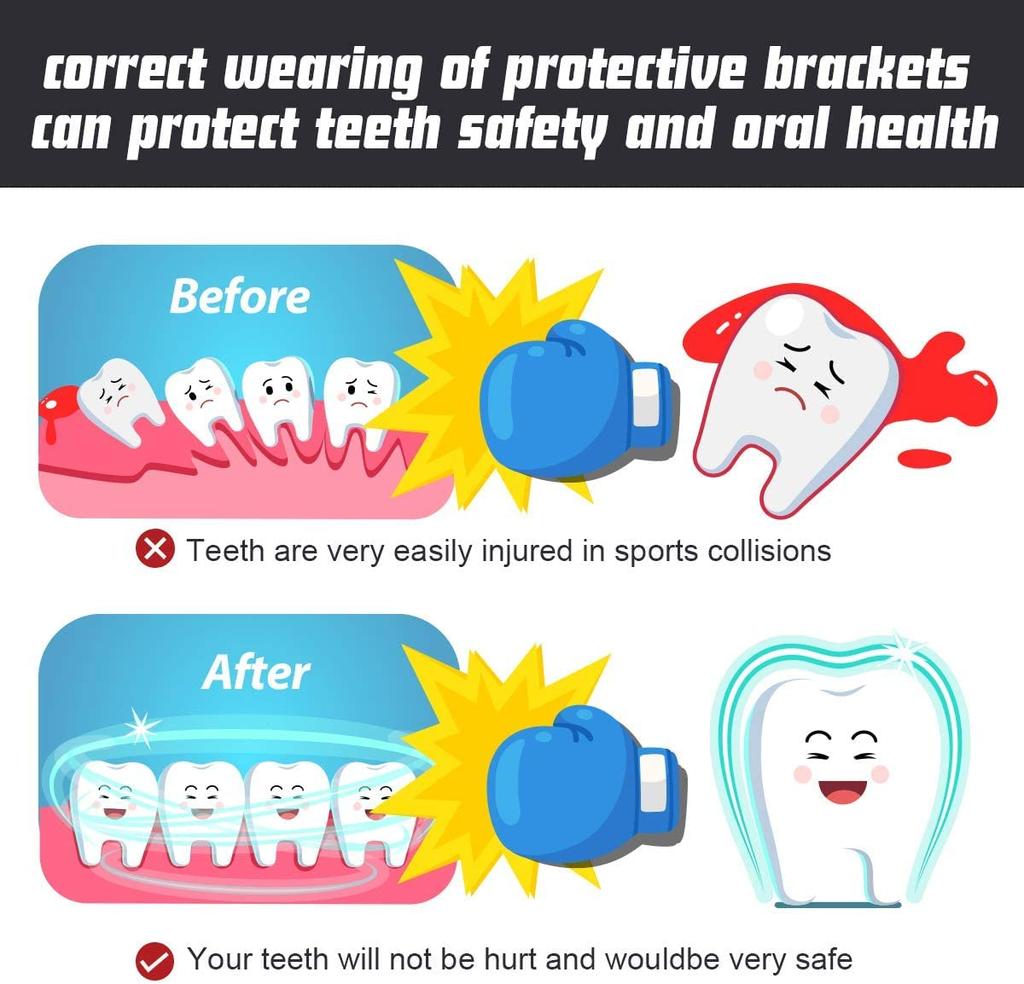Mouthpiece Mouthguard with Case for Strength Martial 2 Colors and Karate, Boxing, Training, Sports, Arts, Exercise, (Black Red)