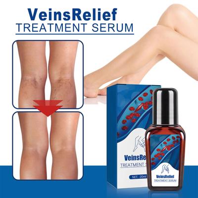 20ml Vein Repairs Fluid, Relieves Leg Varicose Pain, Earthworm Legs With Bulging Veins, Mai Kang Shu