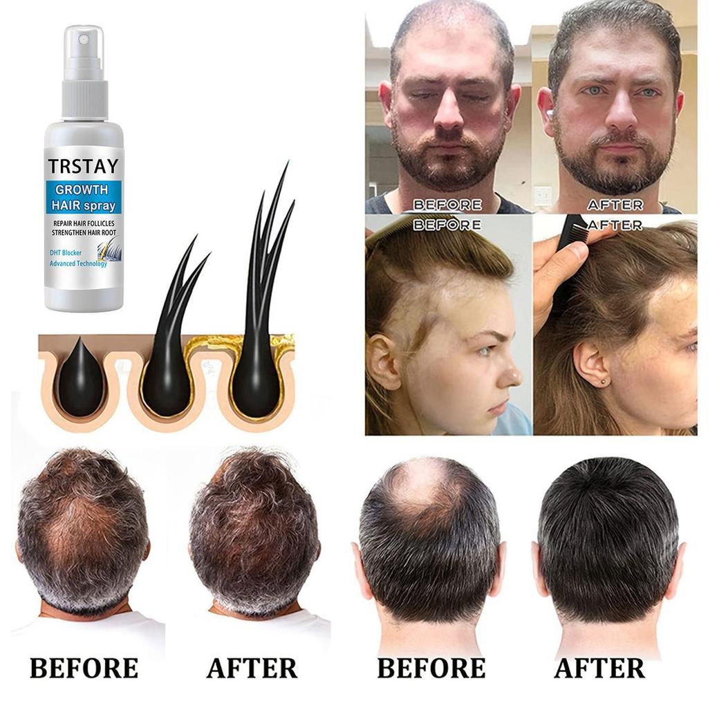 Nourishing Hair and Repairing Damaged Scalp