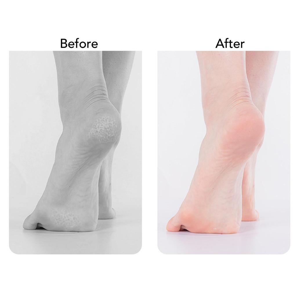 10PCS Electric Foot Grinder Heads Callus Remover Sanding Disc Exfoliating Sandpaper Disk Black Offwhite