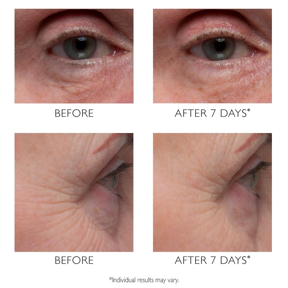 Peter Thomas Roth Potent C  Vitamin C Power Eye Cream