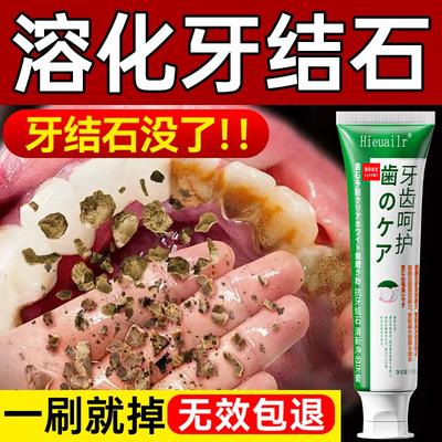 Tartar Removal & Whitening Toothpaste