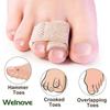 2/6/18/24Pcs Toe Finger Straightener Hammer Tape Hallux Valgus Corrector Bandage Toe Separator Splint Wraps Foot Care Supplies