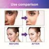 Eelhoe Pimple Patches For Effective Skin Repair And Acne Spot Treatment With 180 Pieces For Clear Complexion