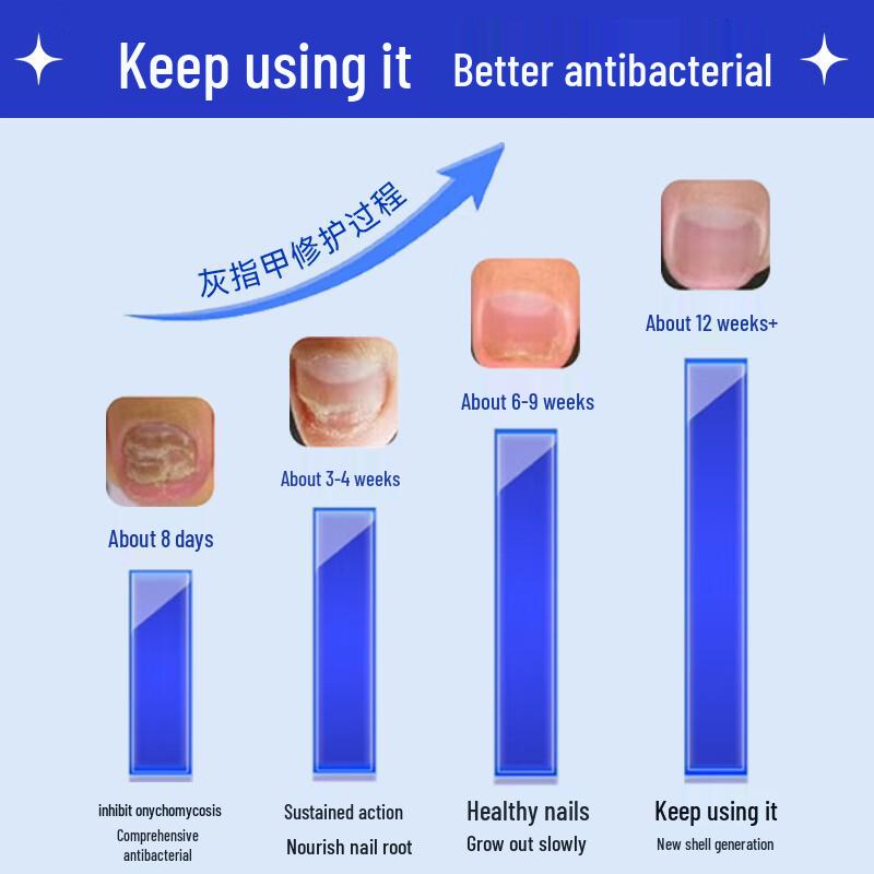 Baibang Qiling Nail Fungus Treatment