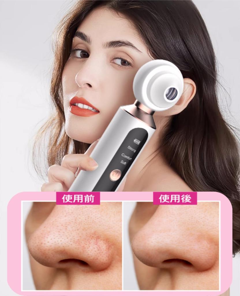 BIGMUMU Pore Nose Vacuum Suction for Magnifying LED Pore Facial Beauty 3 Adjustable Quiet USB Birthday Gift Aspirator, [New 2025, Lens, Built-in