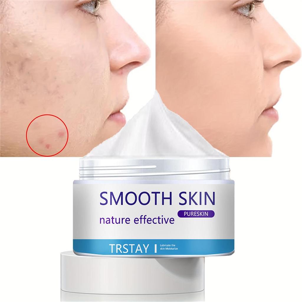Whitening and Acne Removing Essence Cream, Brightening Facial Skin, Anti-oxidation and Anti-aging, Moisturizing Cream