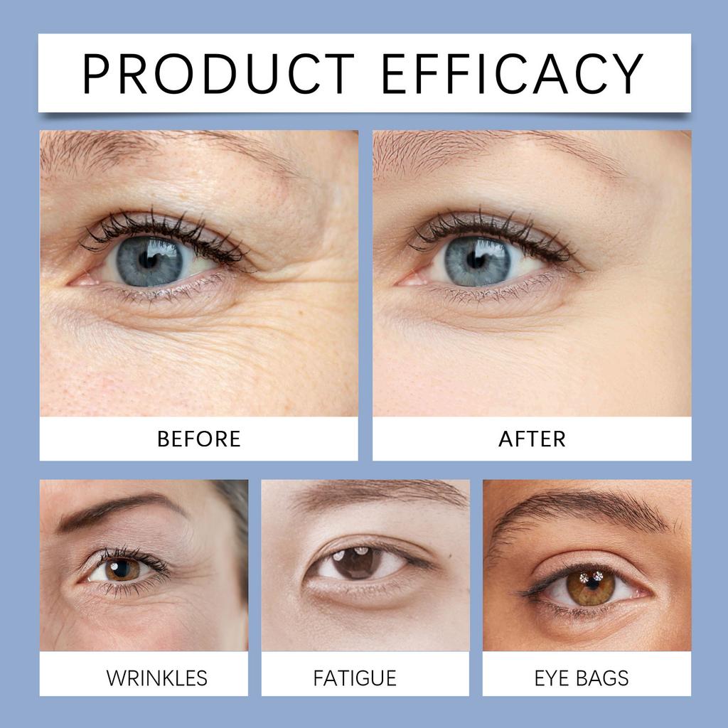 Firming Eye Cream Reduces Dark Circles Eye Bags Puffiness Eyelid Drooping Tightens Improves Fine Lines Deeply Moisturizes And Hydrates.