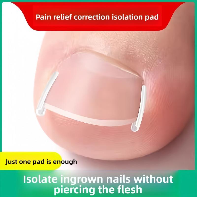 Palm Groove Nail Improvement Device for Ingrown Toenail, Foot Nail Prevention From Growing Into The Flesh, Proper Nail Correction Tool