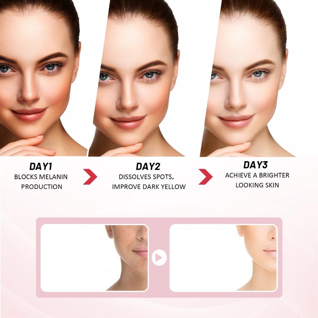 EELHOE 3-Day Hyaluronic Acid Moisturizer Cream - Brighten Skin Tone, Hydrating Cream Tightens and Lightens Spots