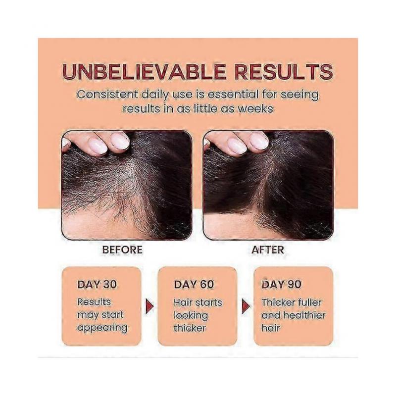 Ulei Batana Brut pentru Creșterea Părului - 100% Pur, Batana Organic din Honduras pentru Păr Natural Gros și Puternic - Mască pentru Scalp pentru Bărbați și Femei