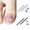 Professional Ingrown Toenail Corrector Clip Pedicure Recover Embed Toe Nail Treatment Ingrown Toenail Straightening Brace Tools