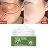 Whitening Acne Sun Burn Black head Face Cream Smooth Whitening Scar Sunburn