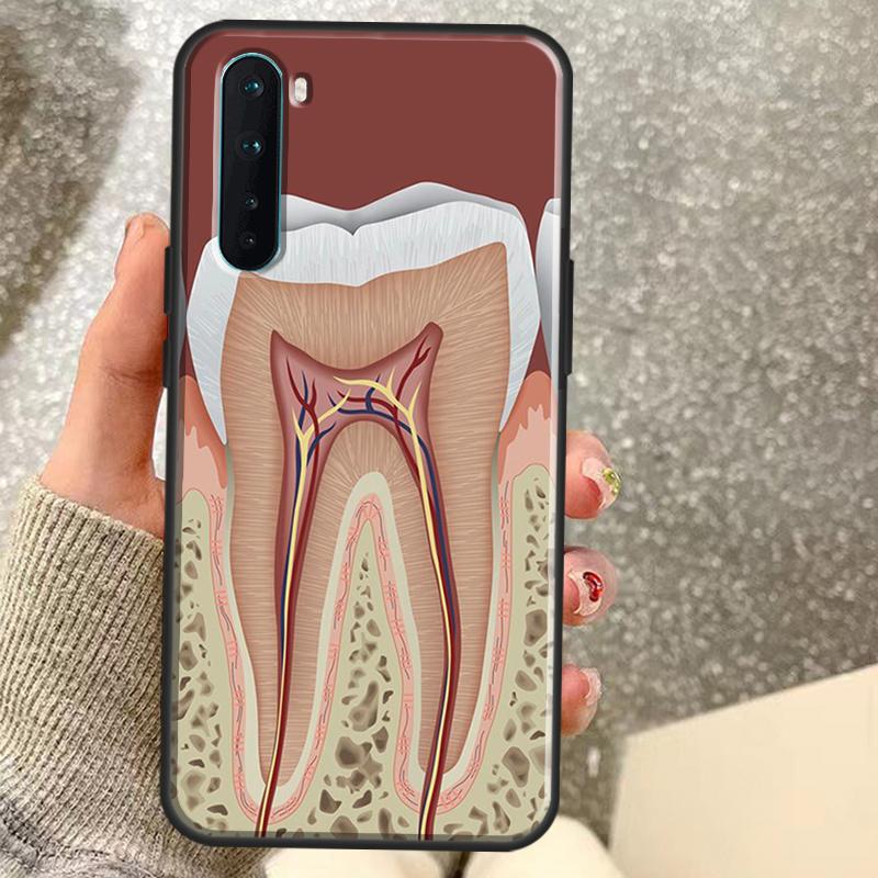 Human Tooth Anatomy Case For OnePlus 13T 10T 8T 10 Pro 15 13 12 11 15R 13R 12R Nord CE 5 2 3 4 Lite N20 N30 Coque