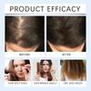Hair Growth Mist Promotes Hair Growth Nourishing Scalp Softening Mist Growth Serum,60ml