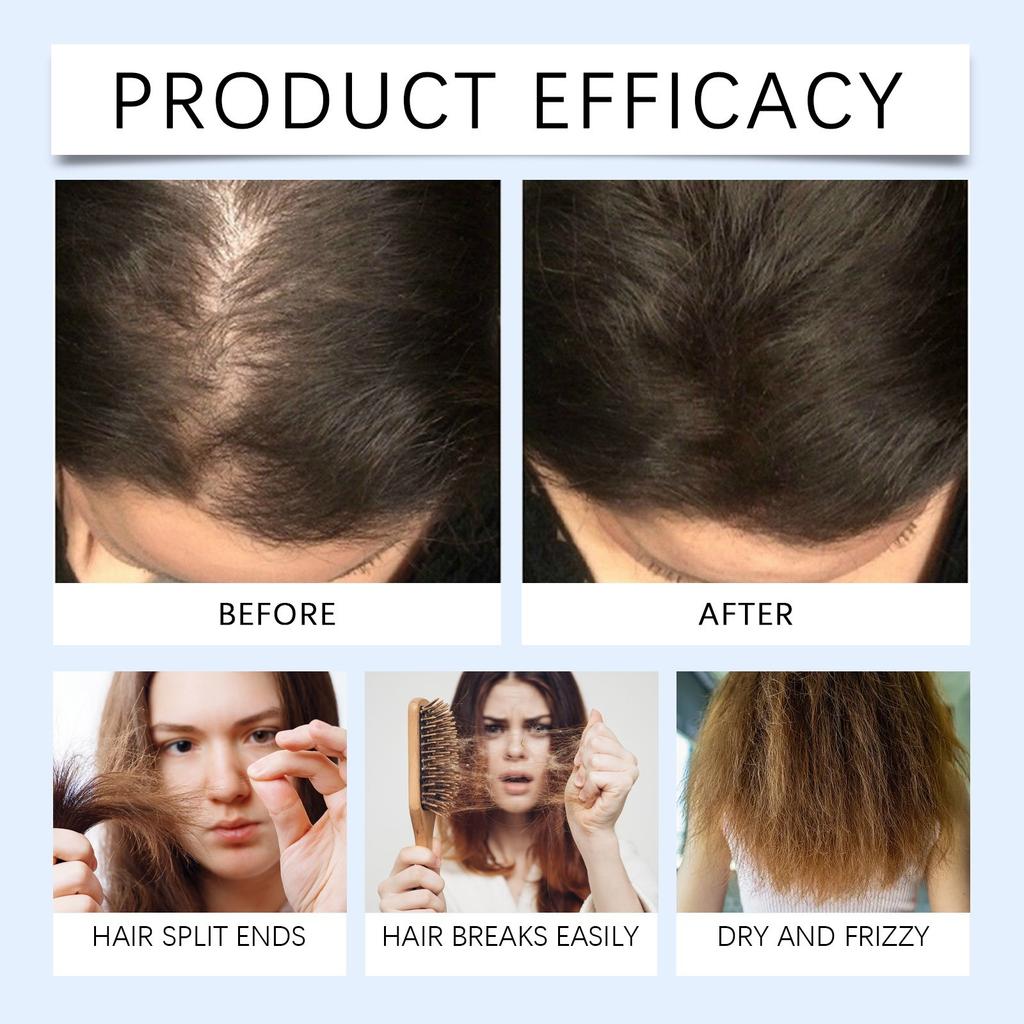 Hair Growth Mist Promotes Hair Growth Nourishing Scalp Softening Mist Growth Serum,60ml