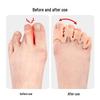 Four-hole Flip-Flop Toe Separator Sandals for Bunion and Hallux Valgus Relief