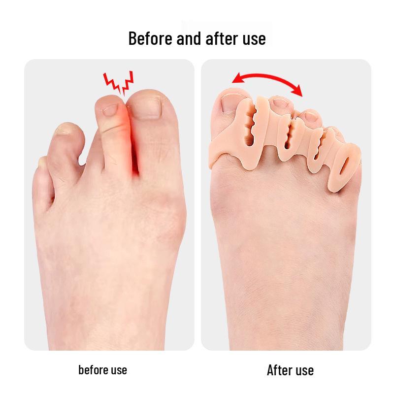 Four-hole Flip-Flop Toe Separator Sandals for Bunion and Hallux Valgus Relief