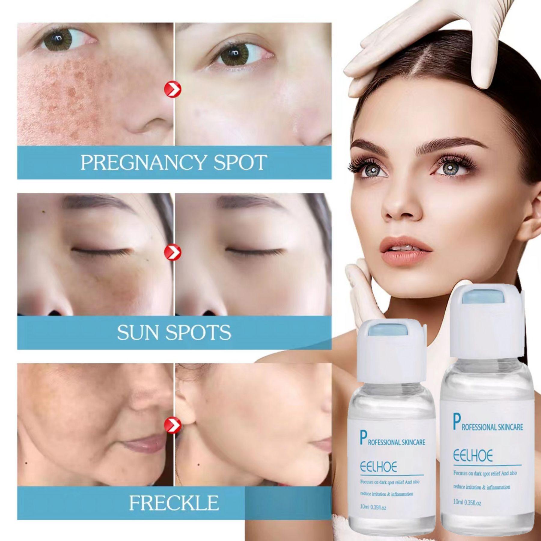 

Эссенция для восстановления кутикулы, успокаивающая кожа, увлажняющая эссенция