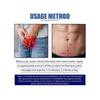 5pcsProstate Ointment Treatment Frequent Urination Prostatitis Urology Infection Renal Insufficiency Cure Kidney Deficiency Cream