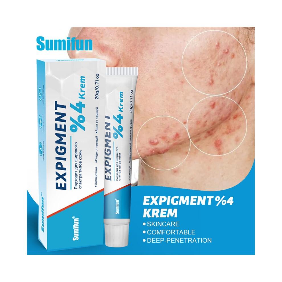 (20g) Brightening Cream Acne, Acne, Scar Skin Care Cream