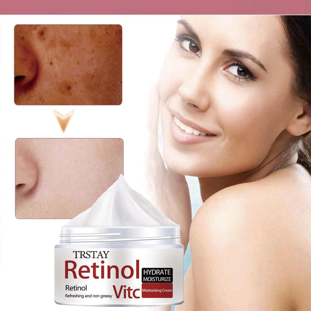 Hyaluronic Acid Cream, Moisturizing and Hydrating, Reducing Collagen Loss, Rejuvenating the Skin, Smoothing Wrinkles