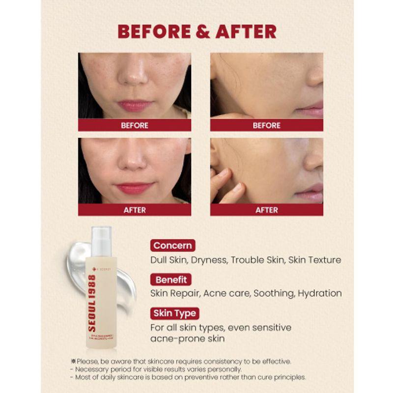 [KSECRET] SEOUL 1988 Essence : Snail Mucin 97% + Rice 100ml