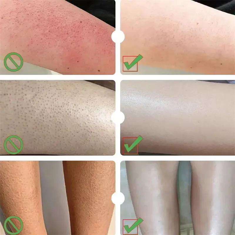 1PC Schönheit Produkt Pflanzliche Anti Riss Fuß Creme Ferse Riss Reparatur Produkte Peeling Abgestorbene Haut Entfernung Erweichung Befeuchten