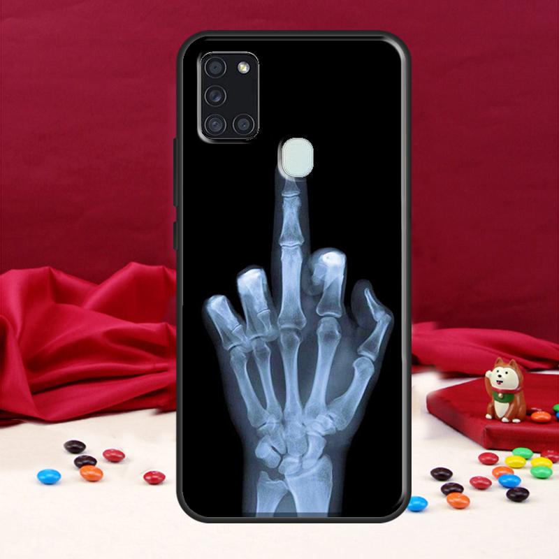 

Скелет Средний Палец Череп Кость Для Samsung Galaxy A34 A54 A14 A52 A32 A22 A12 A13 A53 A11 A51 A71 A50 Чехол для Телефона Samsung A51 4G