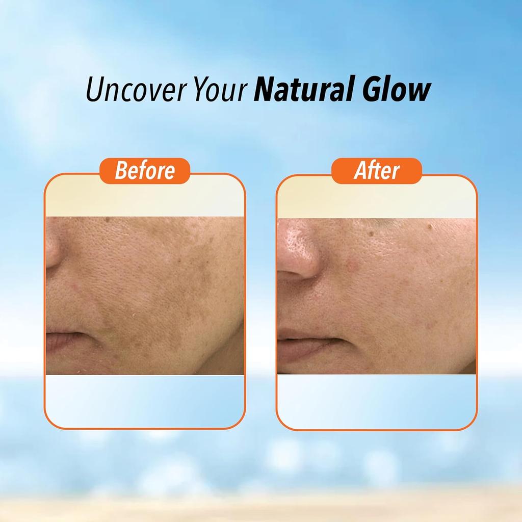 De-Tan Face Pack for Glowing Skin, Oil Control, Acne, Pimples, Detan, Blemishes, Pigmentation & Brightening, Face Cleansing for Face & Body (380 Ml)