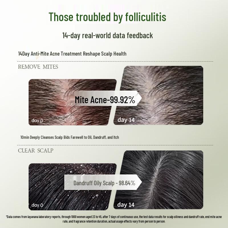 Layanana 1% Selenium Disulfide Anti-Dandruff Shampoo